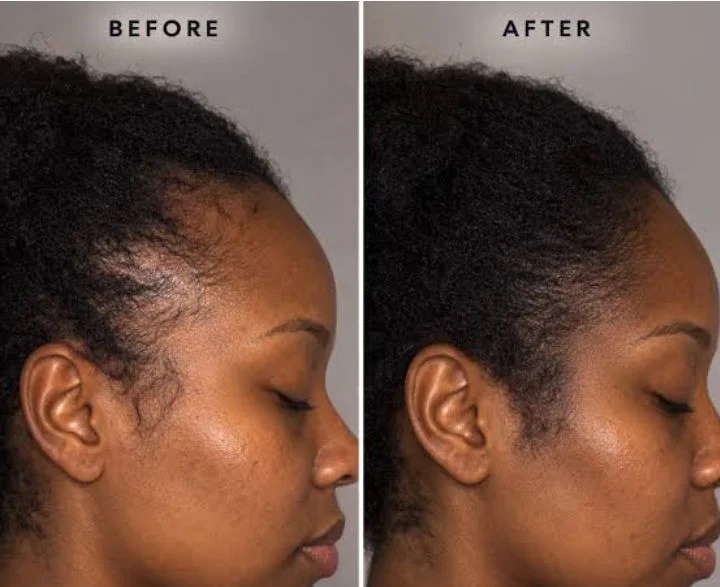 Naturally ME hair product